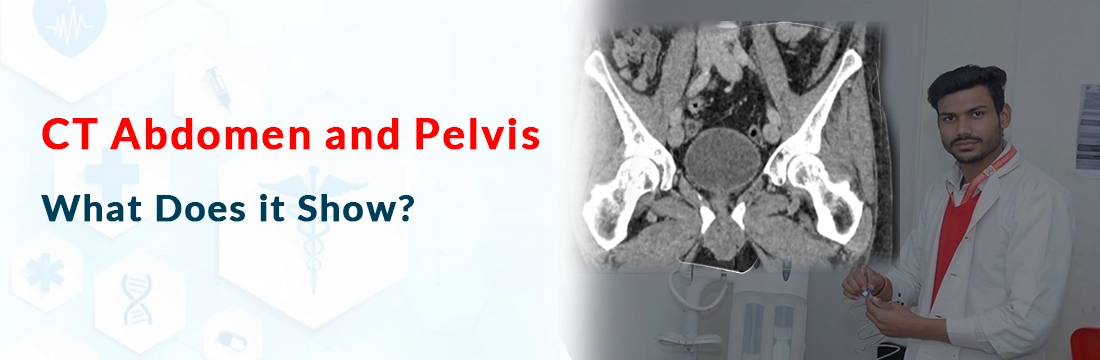 CT Abdomen and Pelvis: What Does it Show?